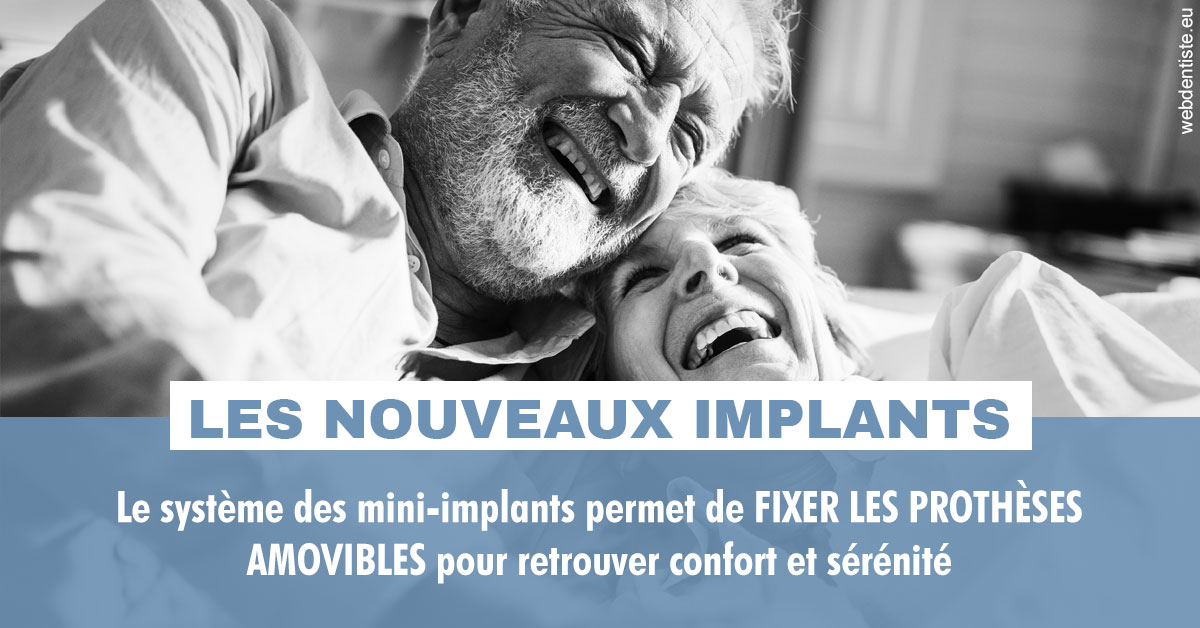 https://dr-buessinger-luc.chirurgiens-dentistes.fr/Les nouveaux implants 2