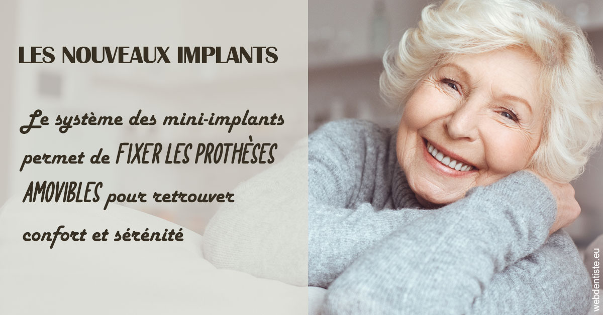 https://dr-buessinger-luc.chirurgiens-dentistes.fr/Les nouveaux implants 1