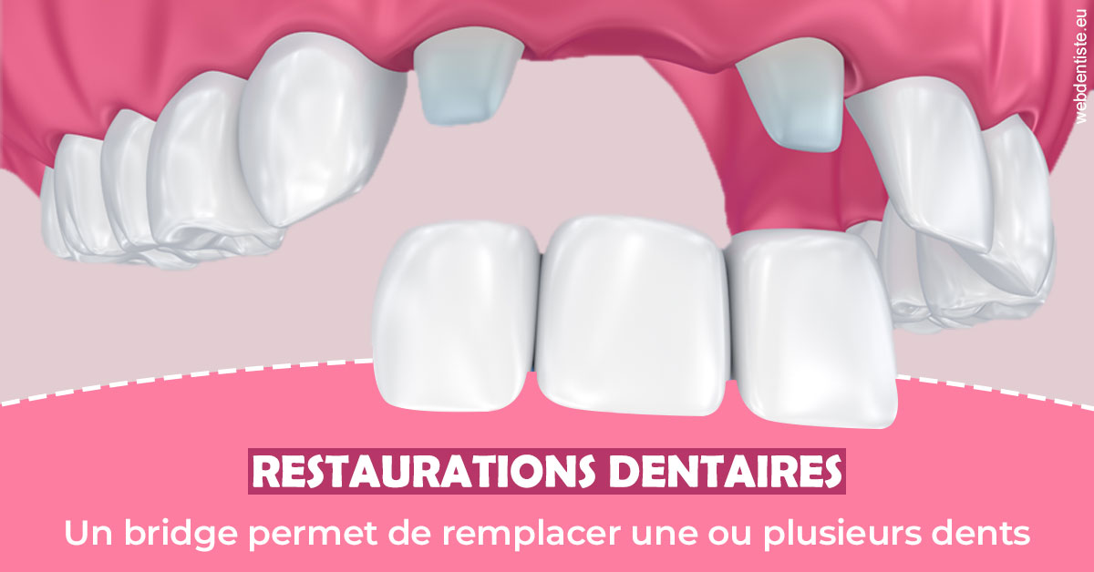 https://dr-buessinger-luc.chirurgiens-dentistes.fr/Bridge remplacer dents 2