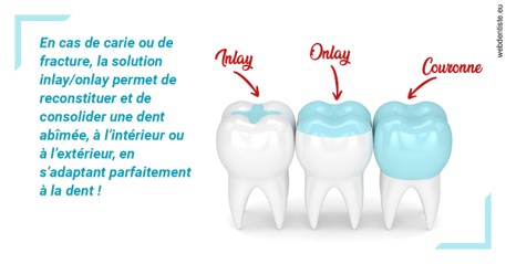 https://dr-buessinger-luc.chirurgiens-dentistes.fr/L'INLAY ou l'ONLAY