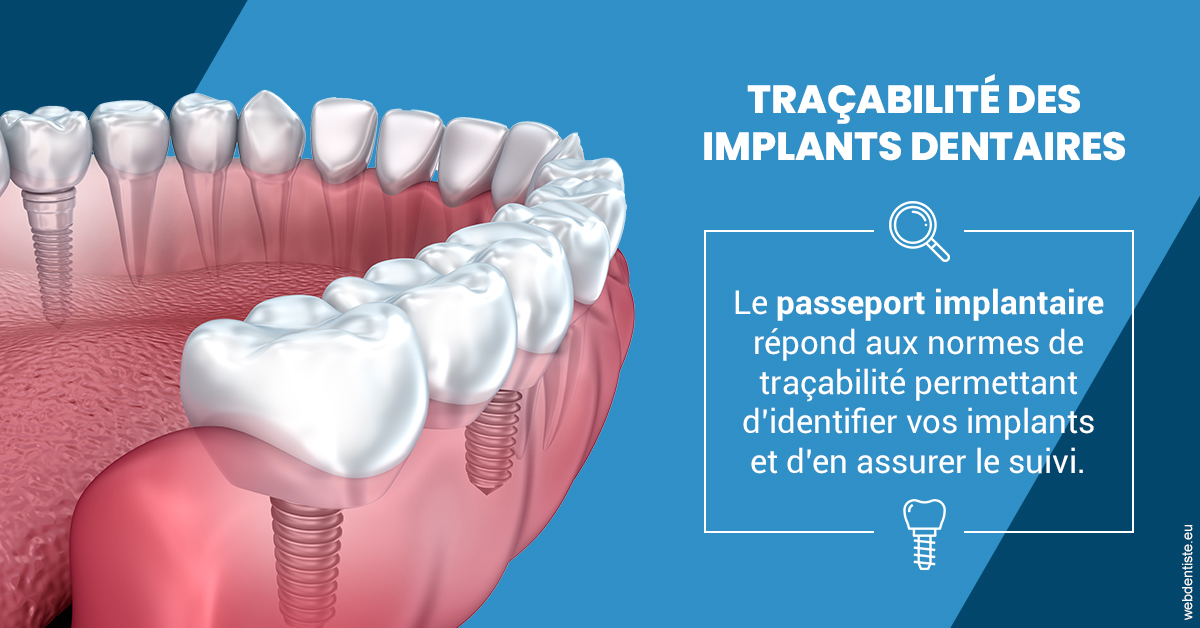 https://dr-buessinger-luc.chirurgiens-dentistes.fr/T2 2023 - Traçabilité des implants 1