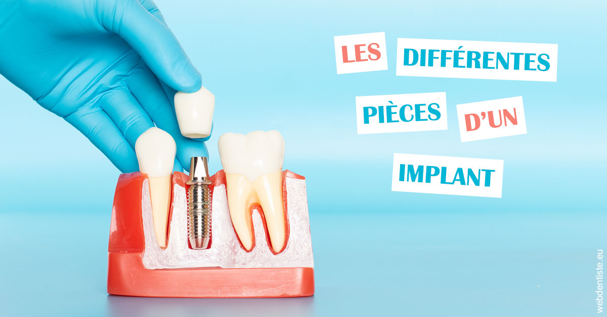 https://dr-buessinger-luc.chirurgiens-dentistes.fr/Les différentes pièces d’un implant 2