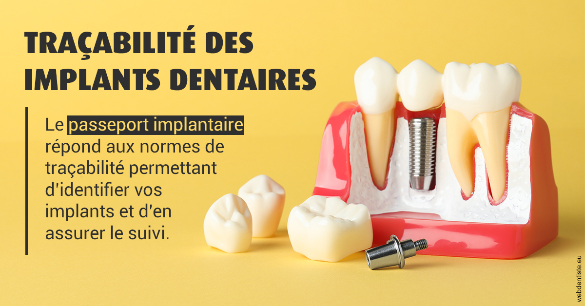 https://dr-buessinger-luc.chirurgiens-dentistes.fr/T2 2023 - Traçabilité des implants 2