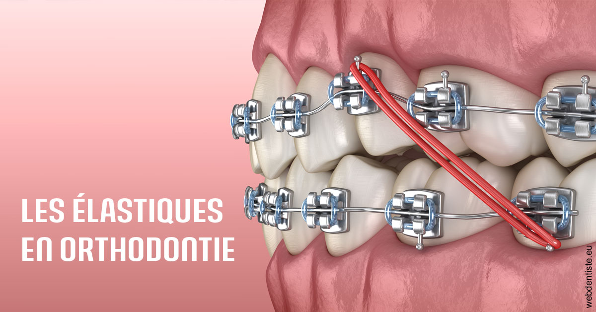 https://dr-buessinger-luc.chirurgiens-dentistes.fr/Elastiques orthodontie 2