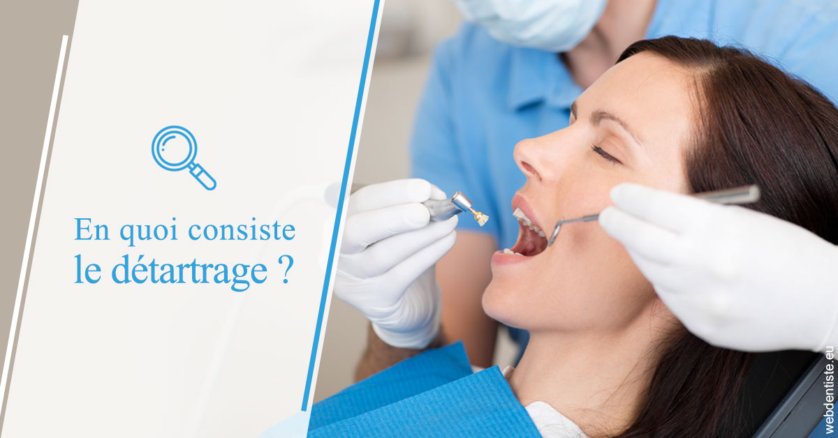 https://dr-buessinger-luc.chirurgiens-dentistes.fr/En quoi consiste le détartrage