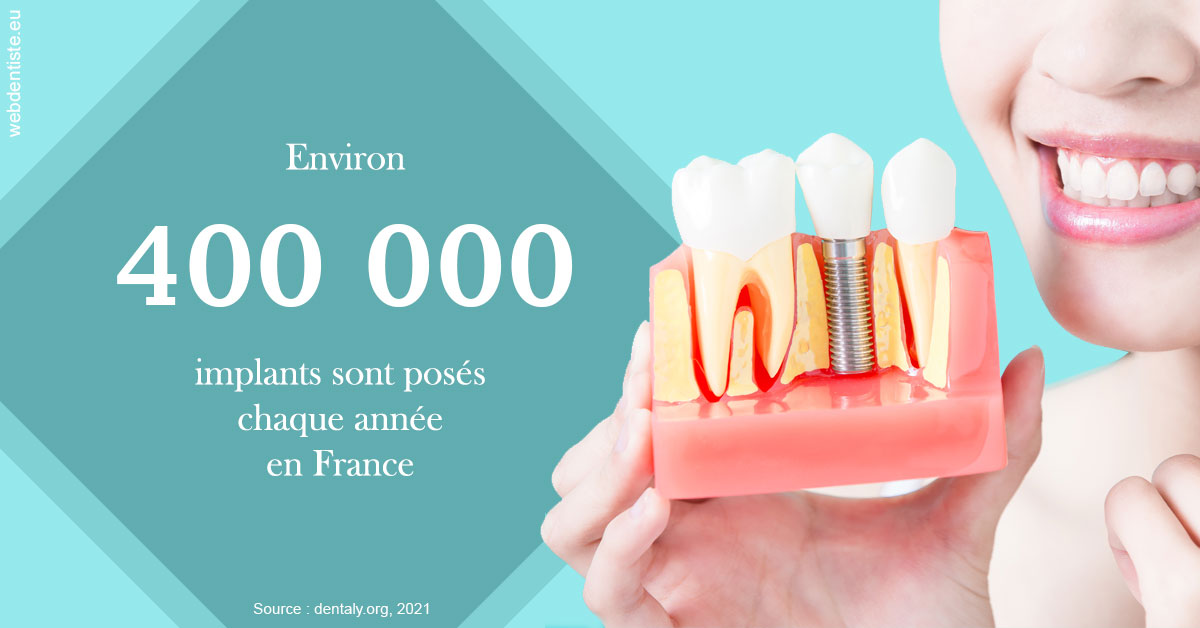 https://dr-buessinger-luc.chirurgiens-dentistes.fr/Pose d'implants en France 2