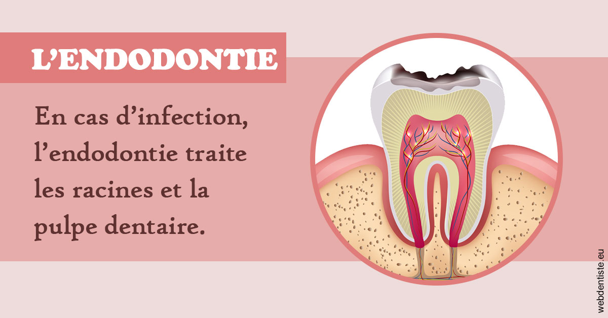 https://dr-buessinger-luc.chirurgiens-dentistes.fr/L'endodontie 2